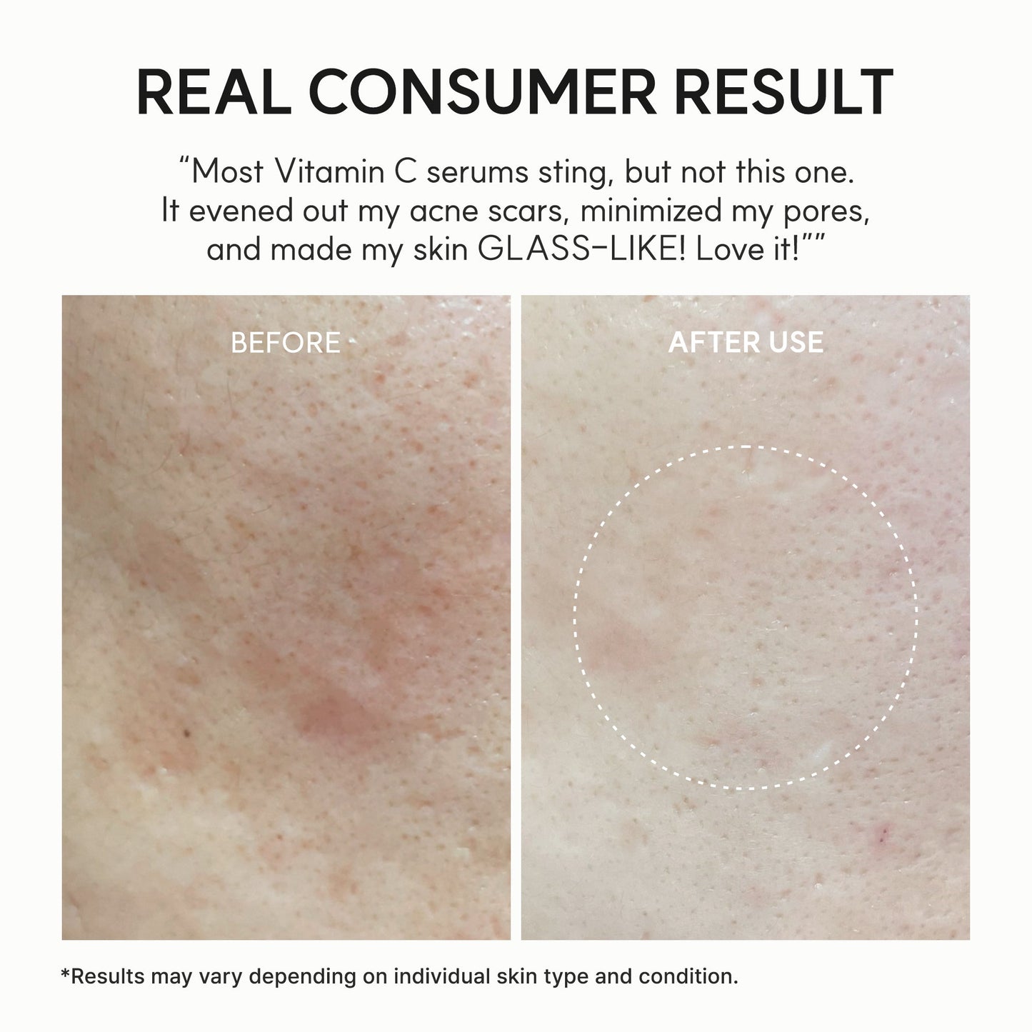 Arencia Glow Shot — Vitamin C + Glutathione Brightening Serum